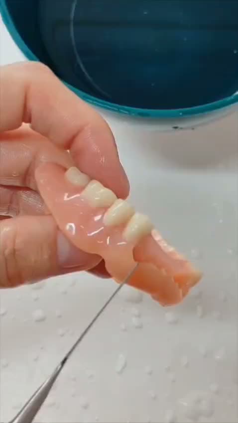 Video tratament HopeDent
